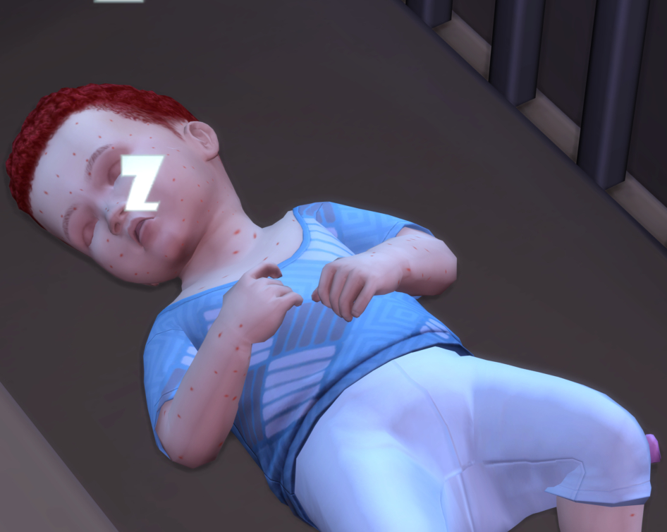 Мод Sims 4 «Детские заболевания и травмы» от LoryNa